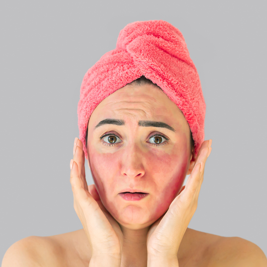 Shea Butter: Your Skin's Best Friend to address Sunburns