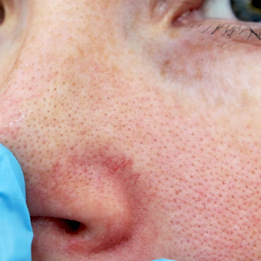 Shea Bliss: Banishing Large Pores with Nature's Special Ingredient